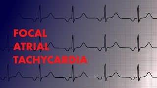 What is Tachycardia [upl. by Airelav]