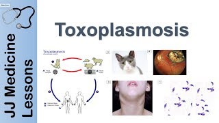 Toxoplasmosis  Acquired vs Congenital  Signs Symptoms Diagnosis and Treatment [upl. by Mcclees]