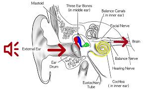 Trigeminal Schwannoma  Radiology Review Course [upl. by Leirud833]