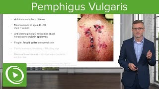 Pemphigus Vulgaris – Dermatology  Lecturio [upl. by Charyl143]