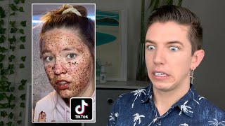 Specialist Reacts to Skin Care TikTok FAILS [upl. by Anayk652]