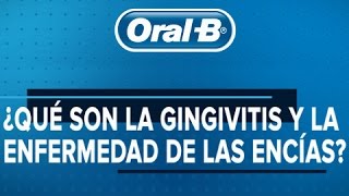 ¿Qué son la gingivitis y la enfermedad de las encías [upl. by Siurtemed145]