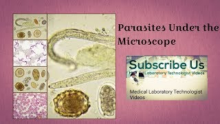 Parasites Under The Microscope [upl. by Arraik260]