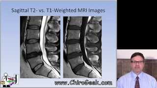 Dr Gillard lectures on How to Read Your Lumbar MRI [upl. by Timmons578]