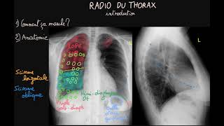 Radio du thorax  Introduction  Partie 1  Docteur Synapse [upl. by Hardunn]