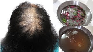 DIY Hibiscus Hair Mask for Extreme Hair Growth  Promote Hair Growth [upl. by Iveel]