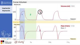 Principios de Ventilacion Mecanica Introduccion [upl. by Ossie786]