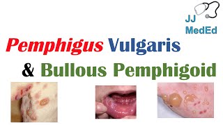 Vesiculobullous Skin Diseases  Pemphigus Vulgaris vs Bullous Pemphigoid [upl. by Anayaran]