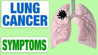 Lung Cancer  All Symptoms [upl. by Ikey39]