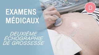 Comment se déroule l’échographie du 2eme trimestre   Echographie morphologique [upl. by Arlene]