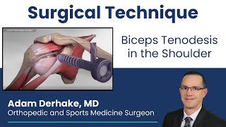 Biceps Tenodesis in the Shoulder Surgical Technique [upl. by Grossman20]