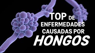 TOP enfermedades causadas por HONGOS [upl. by Bekelja]