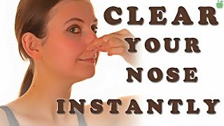 Nosebleeds epistaxis causes prevention treatments and more [upl. by Hillegass80]