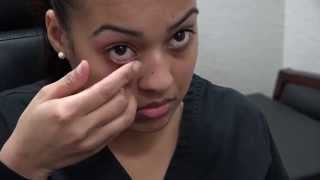 🔴Eye Ointment  How to Apply Eye Ointment Simple [upl. by Kissie]