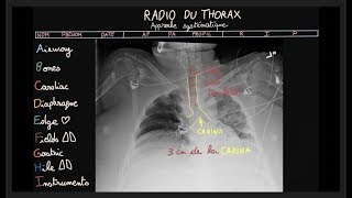 Anatomie du rachis cervical et os hyoïde [upl. by Latsyrhk304]