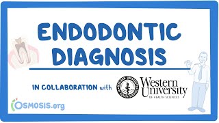 Endodontic Diagnosis in Collaboration w Western University [upl. by Symer]