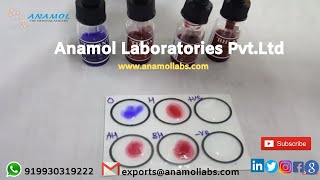 Widal 4x5 ml Test  Widal Test ProcedureIn English [upl. by Betteann807]