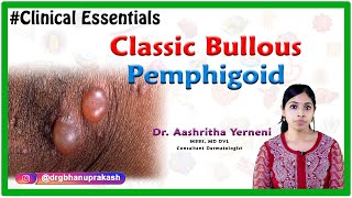 Classic bullous pemphigoid Clinical essentials Dr Aashritha yerneni [upl. by Morita]