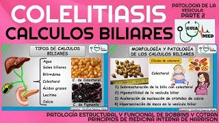 CÁLCULOS BILIARES FISIOPATOLOGÍA PARTE 2  GuiaMed [upl. by Cate245]