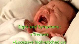 Neonatal Abstinence Syndrome [upl. by Vera657]