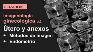 111  Imagen Ginecológica Métodos de estudio y patología endometrial [upl. by Linnie]