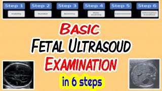 Basic Fetal Ultrasound Examination [upl. by Ahsinaw694]