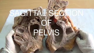 SAGITTAL SECTION OF PELVIS  DEMONSTRATION  ANATOMY [upl. by Daas]