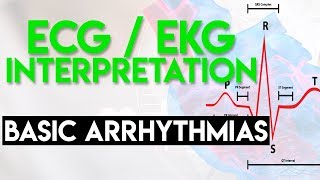 Intro to EKG Interpretation  Practicing Tachyarrhythmia Identification [upl. by Ardnat]