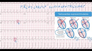 20 ECG  Quiz  Dr Synapse [upl. by Nagear712]