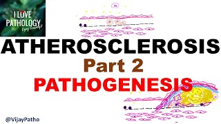 ATHEROSCLEROSIS  Part 2 Pathogenesis [upl. by Dez466]