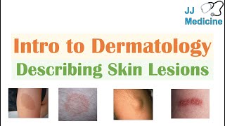 Introduction to Dermatology  The Basics  Describing Skin Lesions Primary amp Secondary Morphology [upl. by Dorina]