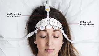 Advanced Noninvasive Monitoring Technologies for Patient Brain Function and Oxygenation [upl. by Highams]