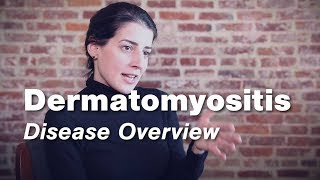 Dermatomyositis  Disease Overview  Johns Hopkins [upl. by Leanora961]