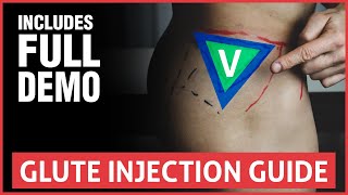 All You Need To Know About Joint Injections [upl. by Salvay556]