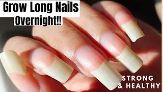 How To Grow Your Nails Really Fast amp Long  Natural Remedy for Long Strong Nails Overnight WORKS [upl. by Inattirb]