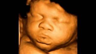 What is 4D ultrasound scan [upl. by Annawit]