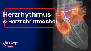 Herzrhythmusstörungen und Herzschrittmacher  Wer braucht ihn  Dr Heart [upl. by Adnorhs]