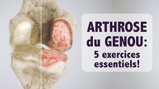 Arthrose du genou 5 exercices ESSENTIELS [upl. by Leahcim]