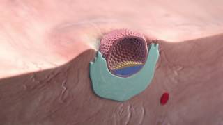 Implantation of the blastocyst [upl. by Brottman]