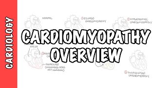 Cardiomyopathy Overview  types dilated hypertrophic restrictive pathophysiology and treatment [upl. by Orofselet]