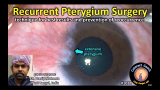 How to apply an eye ointment [upl. by Barcroft]