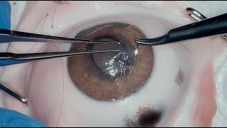 Cornea Suture 101 [upl. by Addy]