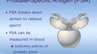 Enlarged Prostate Signs amp Symptoms amp Why They Occur [upl. by Alicirp]