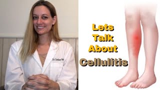 CELLULITIS Everything You Need To Know Symptoms Cause Risk Factors Treatment Prevention [upl. by Harding]