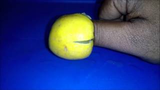 how to remove pus from fingers  Paronychia [upl. by Eglanteen753]