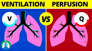 VentilationPerfusion VQ Ratio  Quick Medical Overview [upl. by Cotsen]