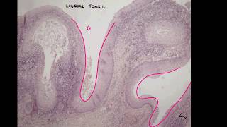 Palatine tonsil lingual tonsil Histology  lymphatic system part 4 [upl. by Aleece]