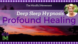 Use Your Powerful Mind Healing Deep Sleep Hypnosis  Mindful Movement [upl. by Aillicirp]