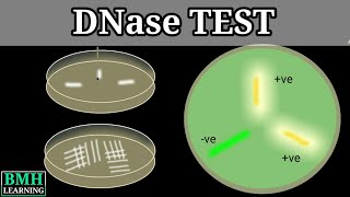 DNase Test  DNase Agar  DNA Hydrolysis Test  DNase Test For Staphylococcus aureus [upl. by Anaahs]