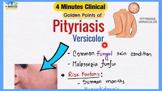 Pityriasis Versicolor Explained Like Water  Symptoms Pathogenesis Treatment  4 Minutes Clinical [upl. by Horner]